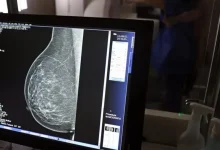 Desenvolvimento de tecnologia de imagem sem compressão para mamografias, utilizando radiação ionizante, para melhorar o diagnóstico precoce de doenças mamárias e reduzir estresse para pacientes.