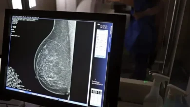 Desenvolvimento de tecnologia de imagem sem compressão para mamografias, utilizando radiação ionizante, para melhorar o diagnóstico precoce de doenças mamárias e reduzir estresse para pacientes.