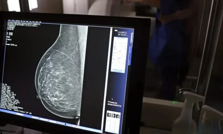 Desenvolvimento de tecnologia de imagem sem compressão para mamografias, utilizando radiação ionizante, para melhorar o diagnóstico precoce de doenças mamárias e reduzir estresse para pacientes.