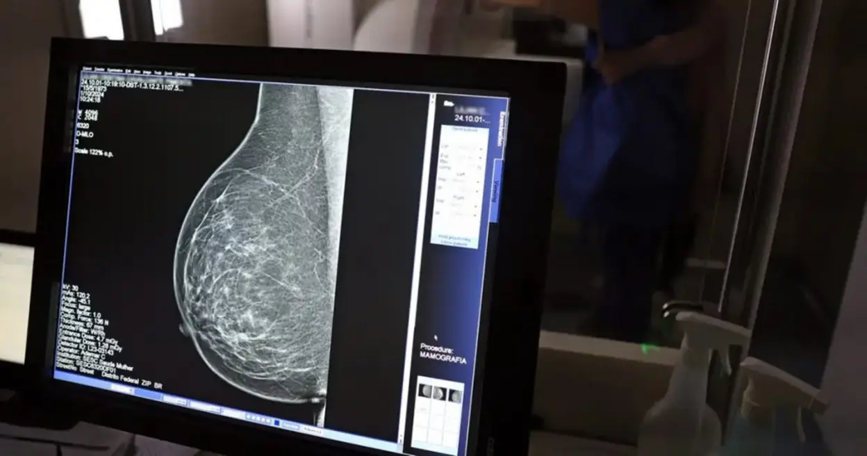 Desenvolvimento de tecnologia de imagem sem compressão para mamografias, utilizando radiação ionizante, para melhorar o diagnóstico precoce de doenças mamárias e reduzir estresse para pacientes.