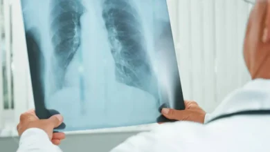 Descoberta de um medicamento inalável mais potente e eficaz contra a tuberculose, desenvolvido pela Unesp com apoio da nanotecnologia, que pode ser administrado por via inalatória e atinge diretamente as células infectadas.