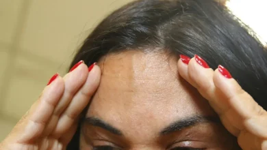 Batida na cabeça: sintomas a ter em mente e como buscar atendimento médico imediato para descartar lesões cerebrais graves, incluindo hematomas e lacerações no cérebro.