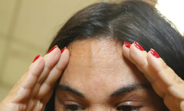 Batida na cabeça: sintomas a ter em mente e como buscar atendimento médico imediato para descartar lesões cerebrais graves, incluindo hematomas e lacerações no cérebro.