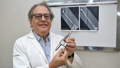 Haste intramedular revoluciona o tratamento de fraturas no fêmur, proporcionando maior precisão, recuperação rápida e menor invasividade. Pacientes se recuperam com mais agilidade e qualidade de vida, retornando às atividades cotidianas com mais segurança e conforto.