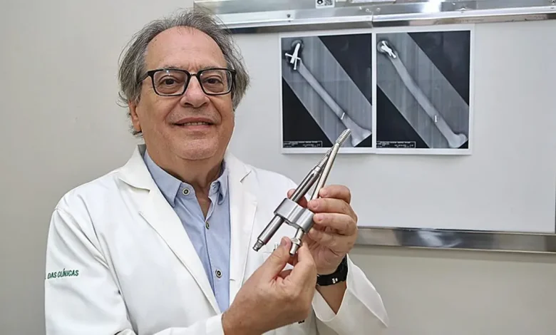 Haste intramedular revoluciona o tratamento de fraturas no fêmur, proporcionando maior precisão, recuperação rápida e menor invasividade. Pacientes se recuperam com mais agilidade e qualidade de vida, retornando às atividades cotidianas com mais segurança e conforto.