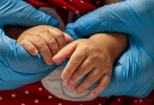 Atrofia muscular espinhal (AME) afeta cerca de 65 pessoas a cada 100 mil no Brasil anualmente. Diagnóstico precoce através do teste do pezinho é crucial para o tratamento adequado. A doença causa fraqueza muscular que pode limitar a locomoção, alimentação e respiração. Saiba mais sobre AME e suas opções de tratamento.