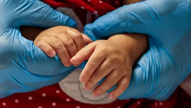 Atrofia muscular espinhal (AME) afeta cerca de 65 pessoas a cada 100 mil no Brasil anualmente. Diagnóstico precoce através do teste do pezinho é crucial para o tratamento adequado. A doença causa fraqueza muscular que pode limitar a locomoção, alimentação e respiração. Saiba mais sobre AME e suas opções de tratamento.