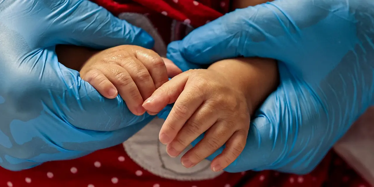 Atrofia muscular espinhal (AME) afeta cerca de 65 pessoas a cada 100 mil no Brasil anualmente. Diagnóstico precoce através do teste do pezinho é crucial para o tratamento adequado. A doença causa fraqueza muscular que pode limitar a locomoção, alimentação e respiração. Saiba mais sobre AME e suas opções de tratamento.