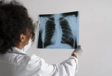 USP desenvolveu tecnologia inovadora com nanopartículas para transportar medicamentos diretamente para áreas inflamadas dos pulmões, prometendo tratamento mais preciso e eficaz para doenças pulmonares.