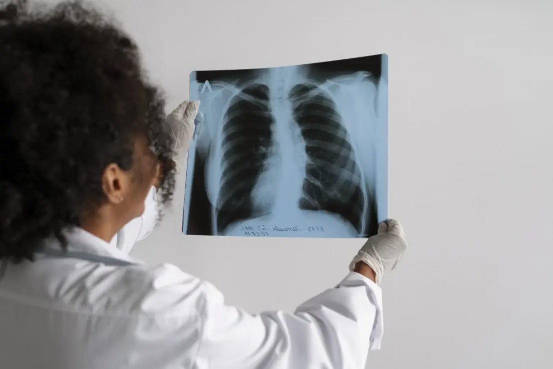 USP desenvolveu tecnologia inovadora com nanopartículas para transportar medicamentos diretamente para áreas inflamadas dos pulmões, prometendo tratamento mais preciso e eficaz para doenças pulmonares.