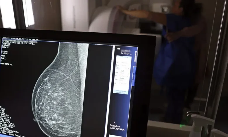 Detecção Precoce do Câncer de Mama em Mulheres Jovens é um Desafio Complexo 1 Detecção precoce do câncer de mama em mulheres jovens é um desafio complexo, principalmente em faixas etárias inferiores a 40 anos, onde a doença pode se apresentar em estágios avançados.