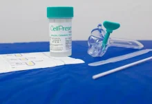 O Brasil adota o teste molecular para detecção do HPV como método principal de rastreamento do câncer de colo do útero, ampliando o diagnóstico precoce e reduzindo o risco de evolução para o câncer invasivo.