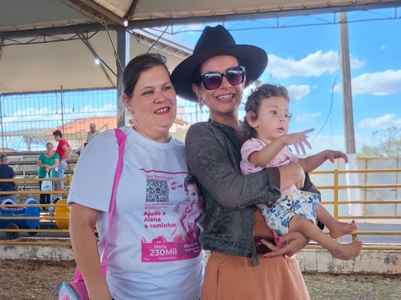 Decisao Judicial Paraguacu Paulista Doenca Rara Deficiencia Femoral Congenita Bilateral Tutela de Urgencia Tratamento Cirurgico Saude Publica Juiz Luis Fernando Vian