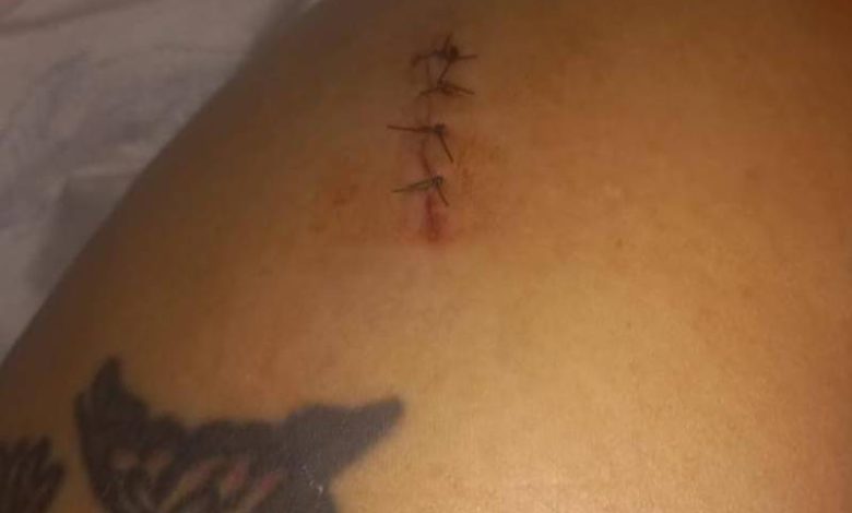 Mulher de 39 Anos em Paraguaçu Paulista Sobrevive a Tentativa de Feminicídio e Cobra Prisão de Ex-Companheiro 1 Tentativa Feminicidio Paraguacu Paulista