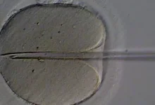 A Organização Mundial da Saúde (OMS) lança diretrizes mundiais sobre infertilidade, com 40 recomendações para prevenir, diagnosticar e tratar a doença, e conscientizar sobre saúde reprodutiva.