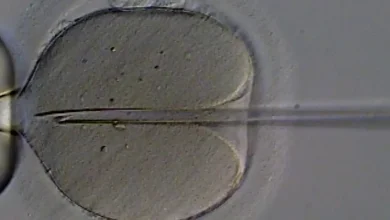 A Organização Mundial da Saúde (OMS) lança diretrizes mundiais sobre infertilidade, com 40 recomendações para prevenir, diagnosticar e tratar a doença, e conscientizar sobre saúde reprodutiva.