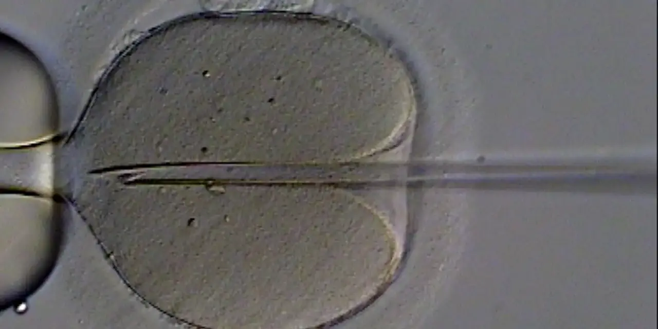 A Organização Mundial da Saúde (OMS) lança diretrizes mundiais sobre infertilidade, com 40 recomendações para prevenir, diagnosticar e tratar a doença, e conscientizar sobre saúde reprodutiva.