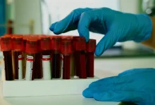 Folha de Paraguaçu revela estudo inovador onde cães treinados detectam câncer agressivo em cães por cheiro. Uma nova esperança para diagnóstico precoce animal.