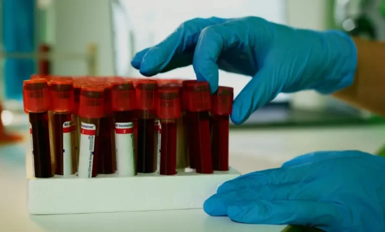 Folha de Paraguaçu revela estudo inovador onde cães treinados detectam câncer agressivo em cães por cheiro. Uma nova esperança para diagnóstico precoce animal.