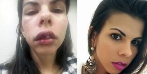 Reeducação de agressores: um caminho para prevenir o feminicídio 3 Reeducação de Agressores