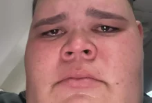 O influenciador digital Gordão da XJ foi internado com um quadro grave na garganta, podendo necessitar de cirurgia. Conheça os detalhes da sua luta pela saúde e um marco em sua recuperação.