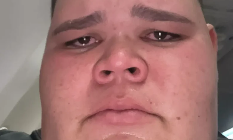 O influenciador digital Gordão da XJ foi internado com um quadro grave na garganta, podendo necessitar de cirurgia. Conheça os detalhes da sua luta pela saúde e um marco em sua recuperação.