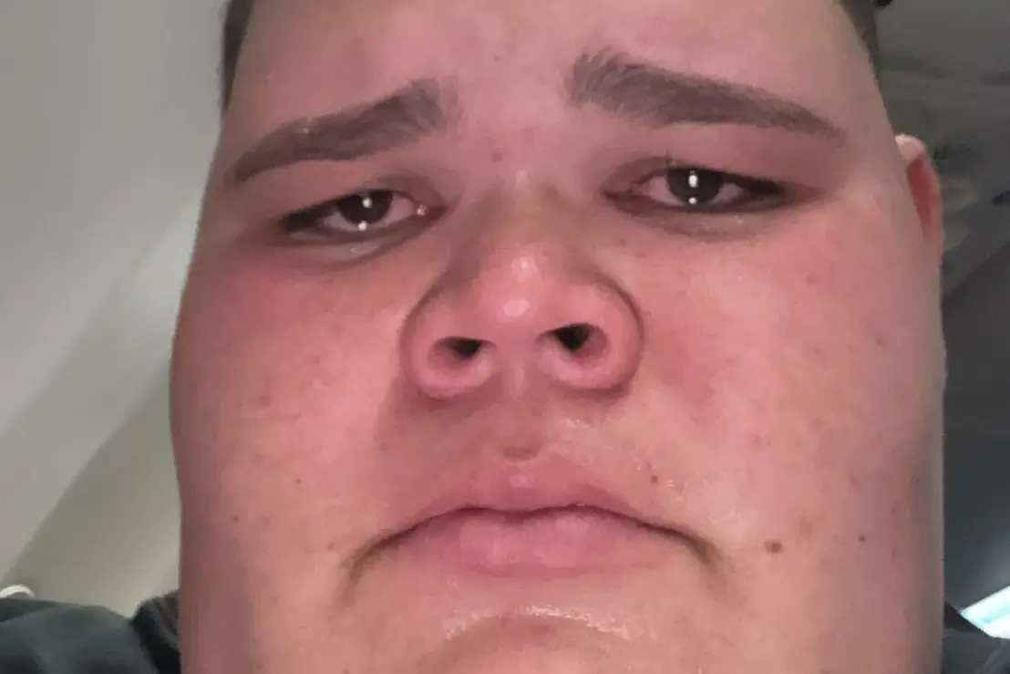 O influenciador digital Gordão da XJ foi internado com um quadro grave na garganta, podendo necessitar de cirurgia. Conheça os detalhes da sua luta pela saúde e um marco em sua recuperação.