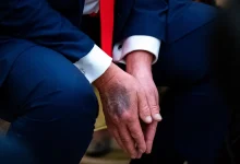 A recente visita de Donald Trump a um centro médico levanta novos questionamentos sobre o real estado de saúde do presidente e seus impactos na política.
