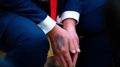 A recente visita de Donald Trump a um centro médico levanta novos questionamentos sobre o real estado de saúde do presidente e seus impactos na política.