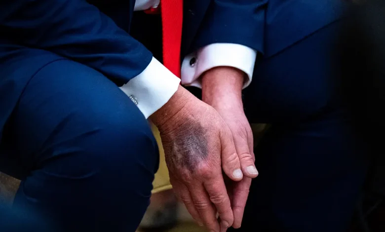 A recente visita de Donald Trump a um centro médico levanta novos questionamentos sobre o real estado de saúde do presidente e seus impactos na política.