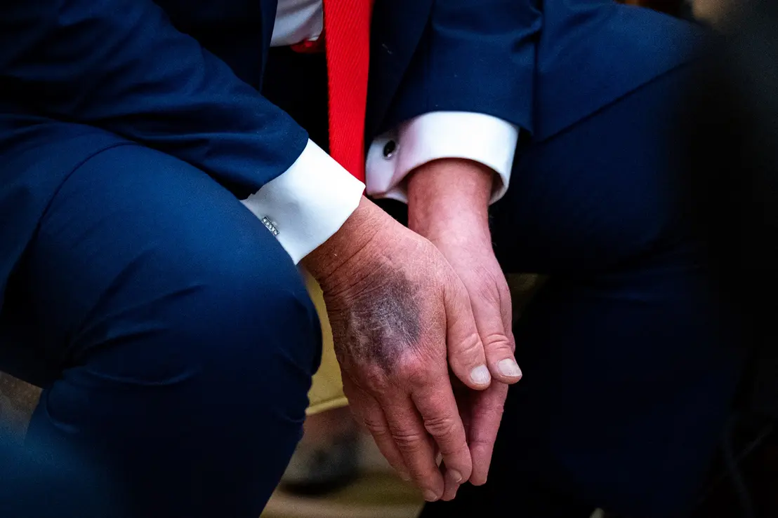 A recente visita de Donald Trump a um centro médico levanta novos questionamentos sobre o real estado de saúde do presidente e seus impactos na política.