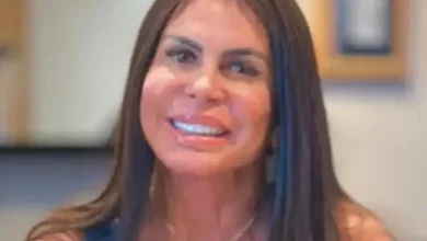 Gretchen revela a causa da alopecia e como superou as falhas no couro cabeludo com micropigmentação. Confira os detalhes dessa jornada de autoestima.