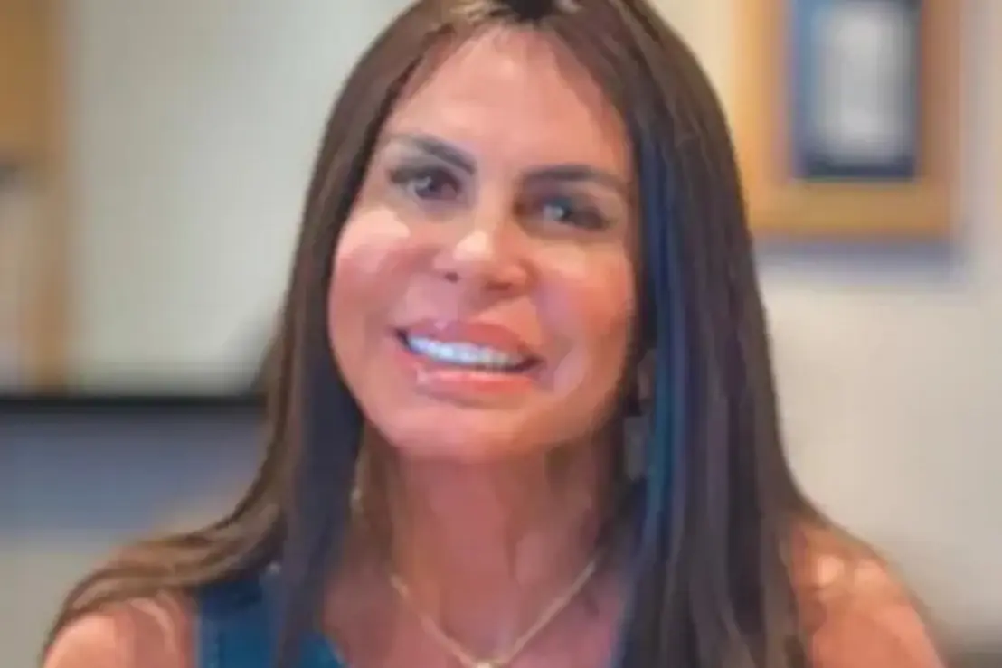 Gretchen abre o jogo sobre alopecia e mostra evolução do cabelo 6 Gretchen revela a causa da alopecia e como superou as falhas no couro cabeludo com micropigmentação. Confira os detalhes dessa jornada de autoestima.