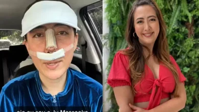 Descubra os perigos do PMMA em procedimentos estéticos faciais, como identificar complicações anos depois e quais são seus direitos como paciente. Um alerta da Folha de Paraguaçu.