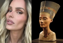 O uso de toxina botulínica no pescoço tem se tornado tendência para quem busca rejuvenescer e definir o contorno facial. Entenda como o procedimento funciona.