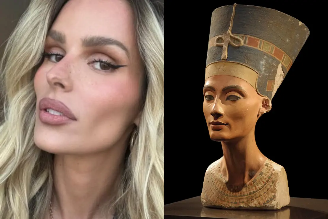 Botox no pescoço: conheça os benefícios para o contorno facial 6 O uso de toxina botulínica no pescoço tem se tornado tendência para quem busca rejuvenescer e definir o contorno facial. Entenda como o procedimento funciona.