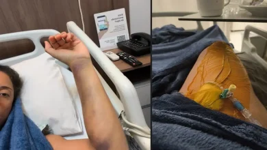 O Tromboembolismo Pulmonar pode ocorrer mesmo em viagens aéreas curtas. Entenda os sinais de alerta e como se prevenir para manter sua saúde em dia.