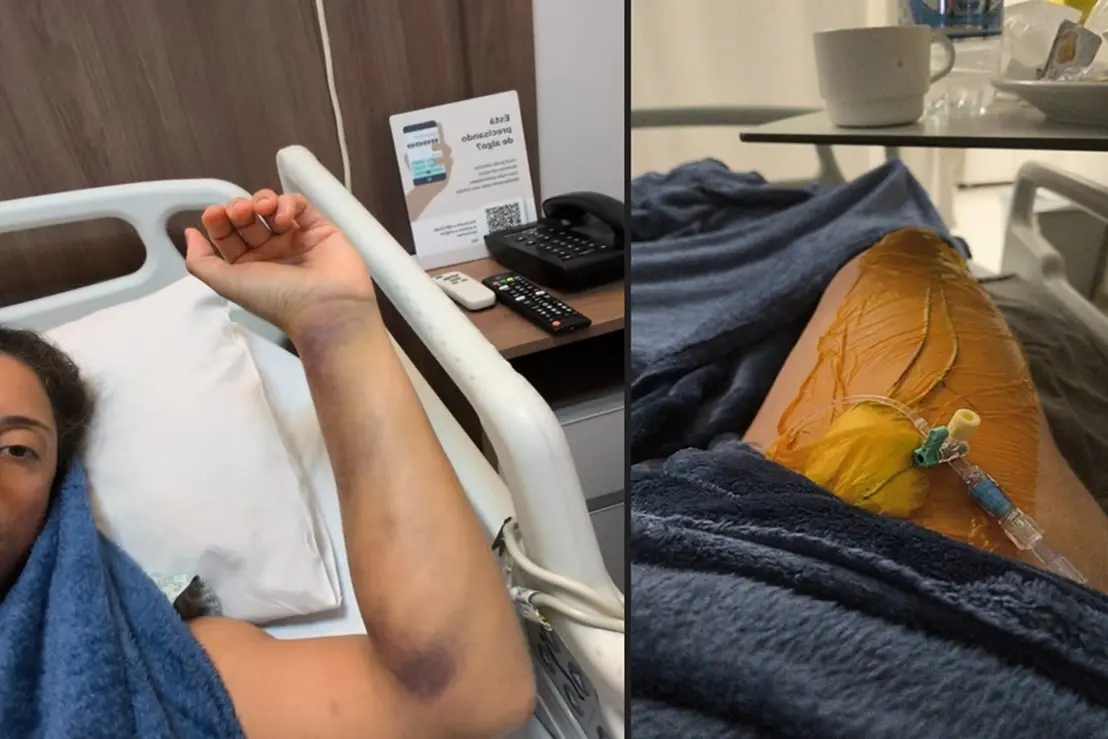 O Tromboembolismo Pulmonar pode ocorrer mesmo em viagens aéreas curtas. Entenda os sinais de alerta e como se prevenir para manter sua saúde em dia.