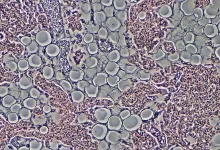 Pesquisadores desenvolvem composto promissor capaz de induzir a queima de gordura no corpo sem a necessidade de reduzir o apetite. Confira os detalhes.