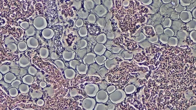 Pesquisadores desenvolvem composto promissor capaz de induzir a queima de gordura no corpo sem a necessidade de reduzir o apetite. Confira os detalhes.