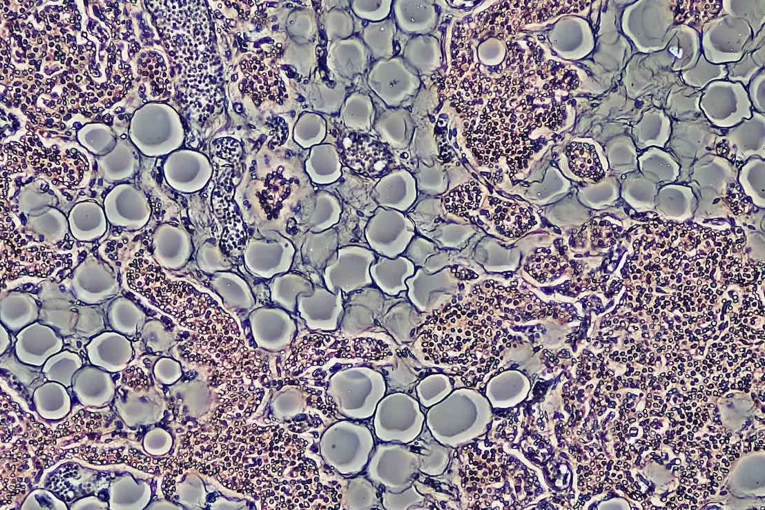 Cientistas testam composto que queima gordura sem inibir fome 6 Pesquisadores desenvolvem composto promissor capaz de induzir a queima de gordura no corpo sem a necessidade de reduzir o apetite. Confira os detalhes.