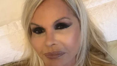 O minilifting tem ganhado destaque no mundo da estética. Entenda como funciona a técnica de rejuvenescimento facial que conquistou celebridades.