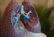 Estudos revelam a presença alarmante de microplásticos em tecidos pulmonares de pacientes diagnosticados com câncer, levantando alertas sobre saúde pública.