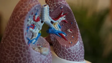 Estudos revelam a presença alarmante de microplásticos em tecidos pulmonares de pacientes diagnosticados com câncer, levantando alertas sobre saúde pública.