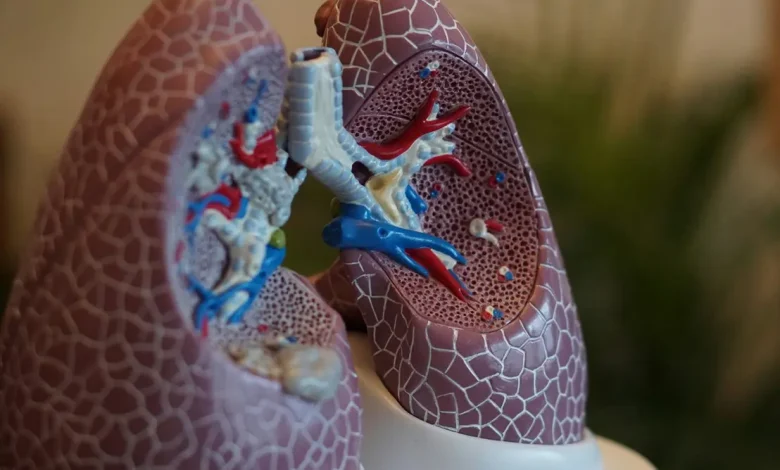 Estudos revelam a presença alarmante de microplásticos em tecidos pulmonares de pacientes diagnosticados com câncer, levantando alertas sobre saúde pública.
