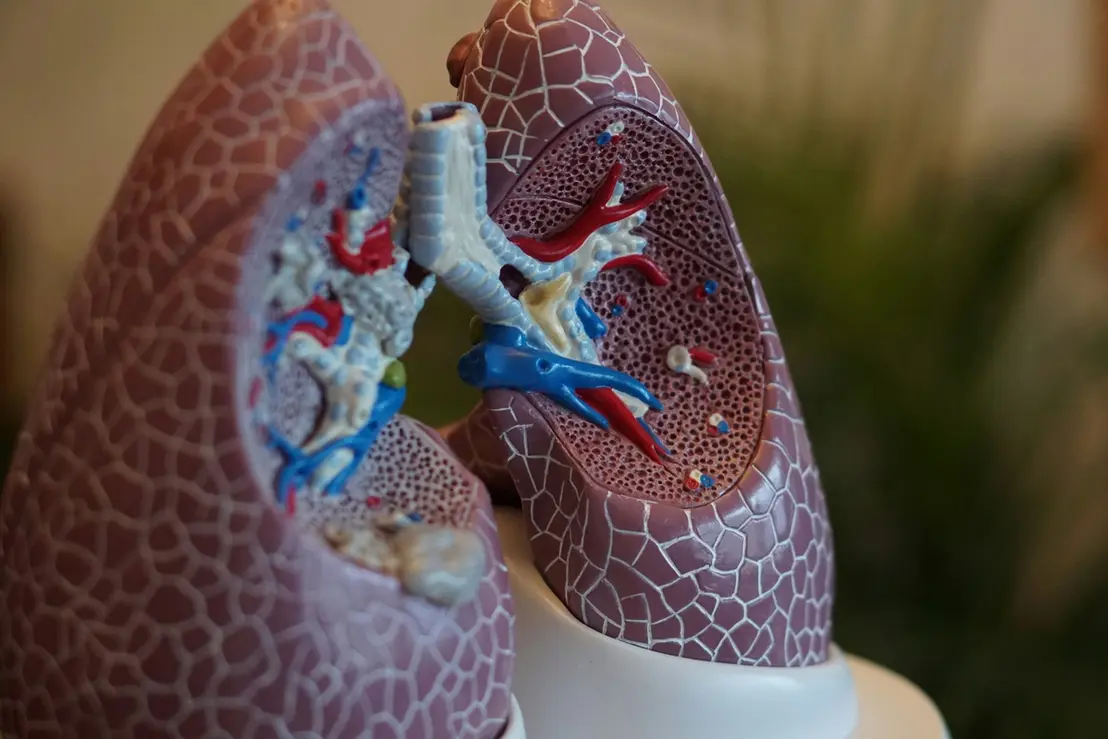 Estudos revelam a presença alarmante de microplásticos em tecidos pulmonares de pacientes diagnosticados com câncer, levantando alertas sobre saúde pública.