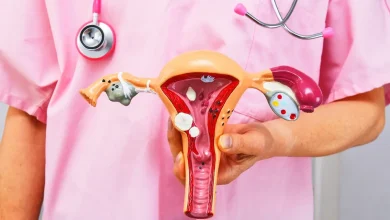 Planos de saúde devem cobrir DIU hormonal para endometriose 3 A ANS determinou que operadoras de planos de saúde cubram o DIU hormonal para o tratamento da endometriose. Confira os detalhes desta mudança.