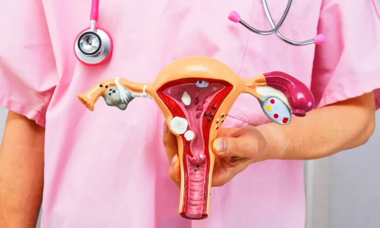 A ANS determinou que operadoras de planos de saúde cubram o DIU hormonal para o tratamento da endometriose. Confira os detalhes desta mudança.