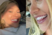 A moda de aplicar joias nos dentes ganhou força com influenciadores, mas especialistas alertam para riscos de cáries, infiltrações e danos ao esmalte dental.