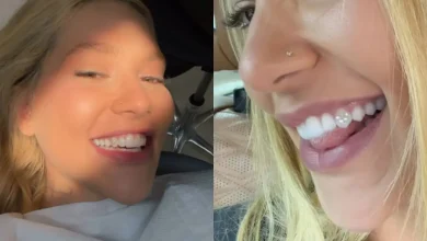 A moda de aplicar joias nos dentes ganhou força com influenciadores, mas especialistas alertam para riscos de cáries, infiltrações e danos ao esmalte dental.